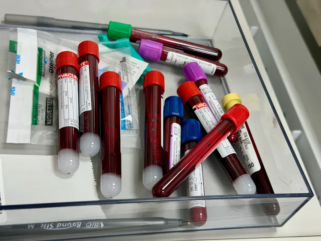 Photo of esame del sangue base: Confronta il prezzo di esame del sangue base in diversi paesi e vedi quanto pesa sul salario medio locale