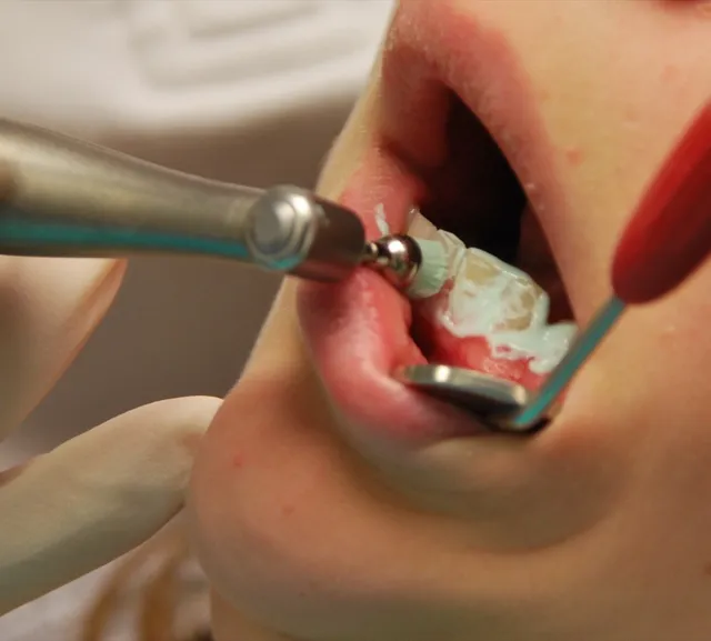 Photo of pulizia dentale: Confronta il prezzo di pulizia dentale in diversi paesi e vedi quanto pesa sul salario medio locale